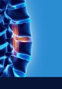 Verita Neuro - LamiSpine - Header