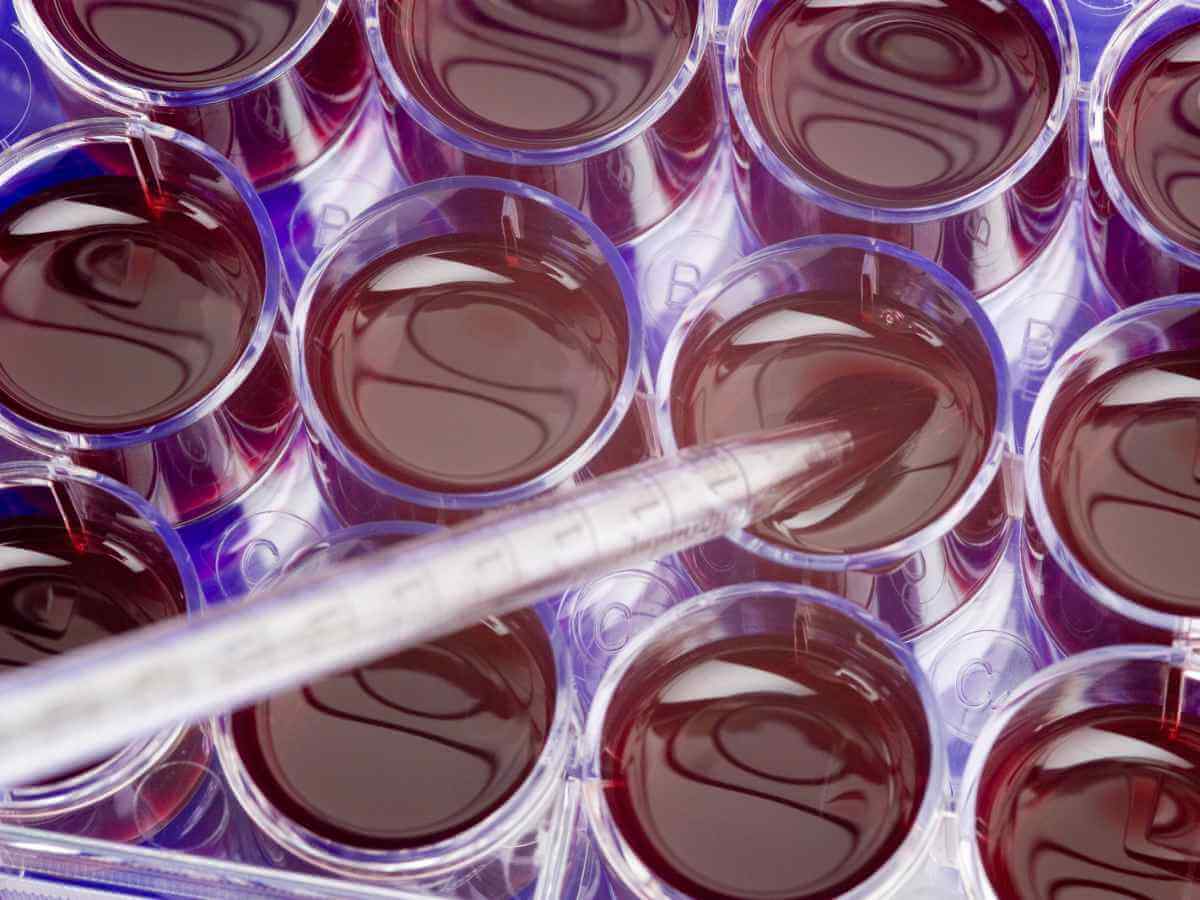 Verita Neuro - Blog - Header Image - Use Of Stem Cells For Spinal Cord Injury Treatment - Verita Neuro