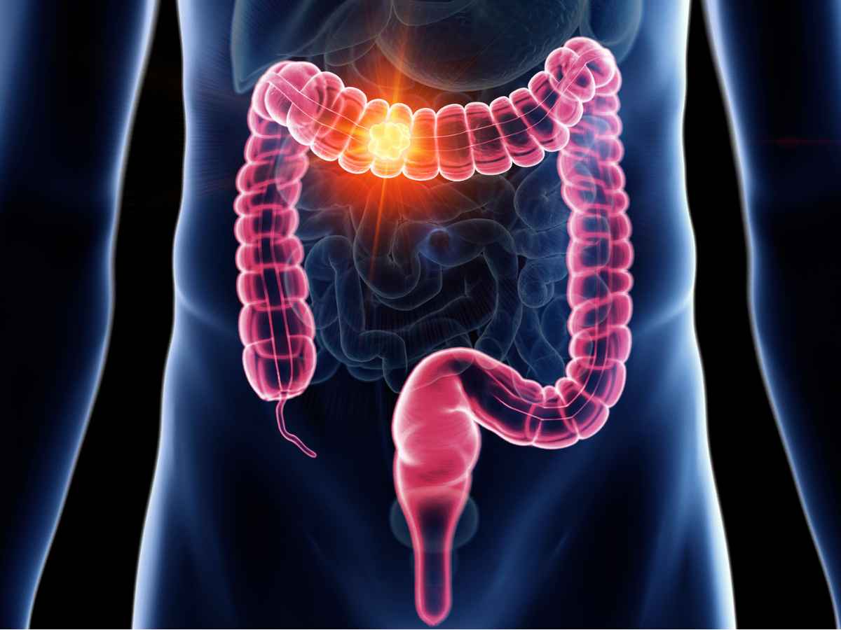 Verita Neuro - Blog - Header Image - Neurogenic Bowel Dysfunction & Spinal Cord Injury