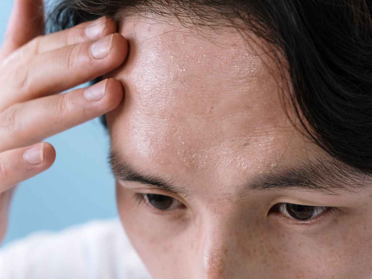 Verita Neuro blog header image - Thermoregulation after SCI showing patient struggling to regulate temperature and sweating